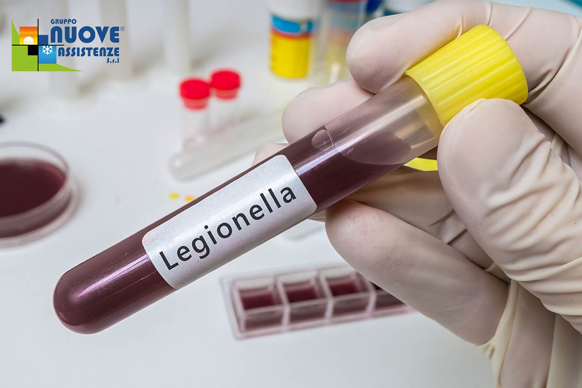 Legionella condizionatori